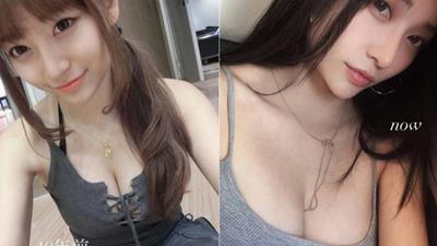 Bị nghi “dao kéo” vòng một suốt nhiều năm, hot girl bất ngờ tung bằng chứng minh oan