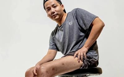 Khoa Pug chi 3 tỷ kéo chân lần 2: Bác sĩ nói gì?