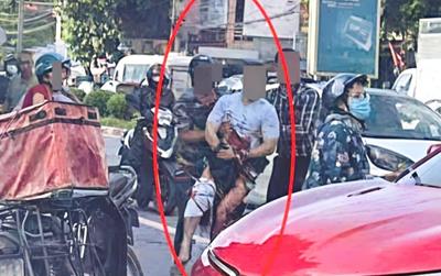 Vụ Tiktoker nổi tiếng ở Thái Nguyên bị chém đứt bàn tay giữa đường